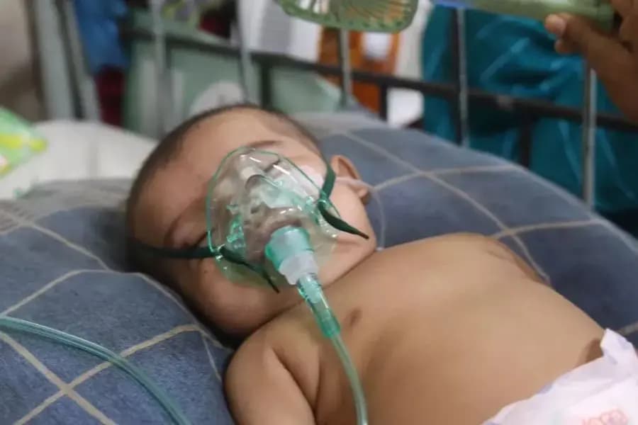 Two more die of Measles-like symptoms, toll hits 805