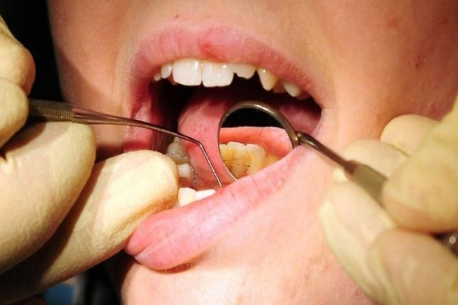 Court orders dentist son to repay mother for raising him