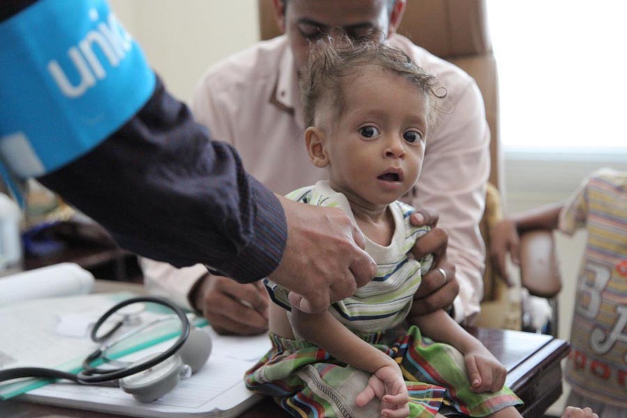 Yemen crisis: 85,000 children 'dead from malnutrition'