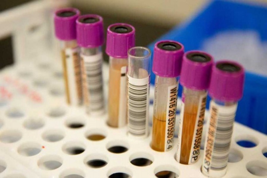 Convalescent plasma samples in vials are seen before being tested for COVID-19 antibodies at the Bloodworks Northwest Laboratory during the coronavirus disease (COVID-19) outbreak in Renton, Washington, US, Sept 9, 2020. REUTERS