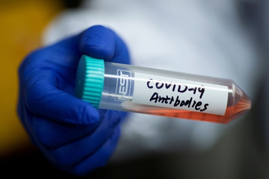 Covid antibody test: Why is the delay? 
