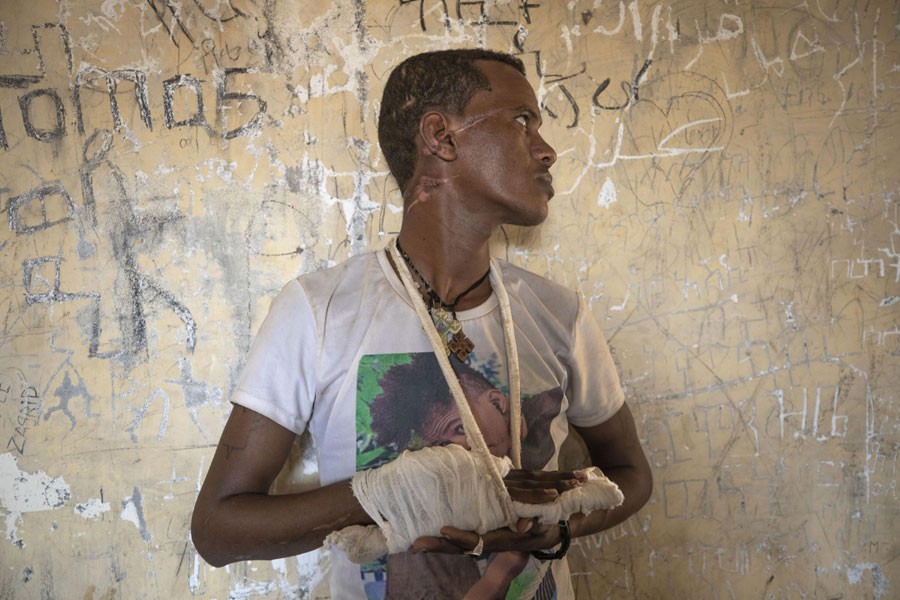 Ethnic Tigrayan survivor Abrahaley Minasbo, 22, from Mai-Kadra, Ethiopia, shows wounds from machetes he says were inflicted by a pro-government militia on Nov 9, inside a shelter in Hamdeyat Transition Center near the Sudan-Ethiopia border, in eastern Sudan on Dec 15, 2020.