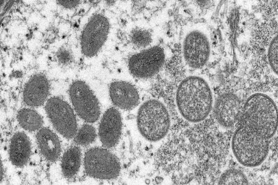 Israel confirms 1st monkeypox case