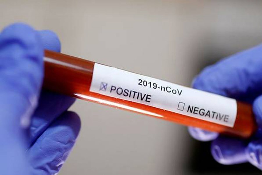 Representational image: Test tube with the coronavirus name label is seen in this illustration taken on January 29, 2020. Reuter/Files
