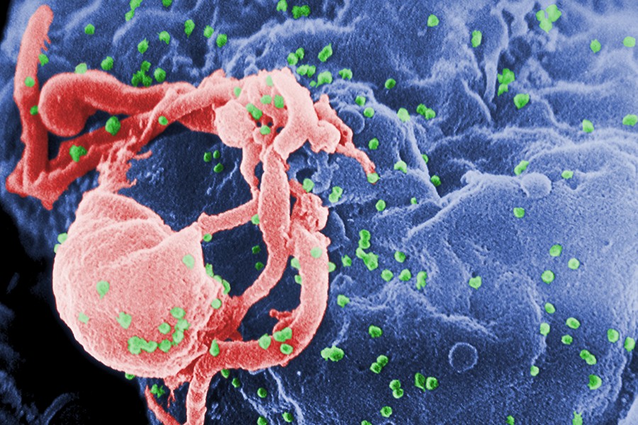 Namibia finds winning formula for HIV despite COVID-19