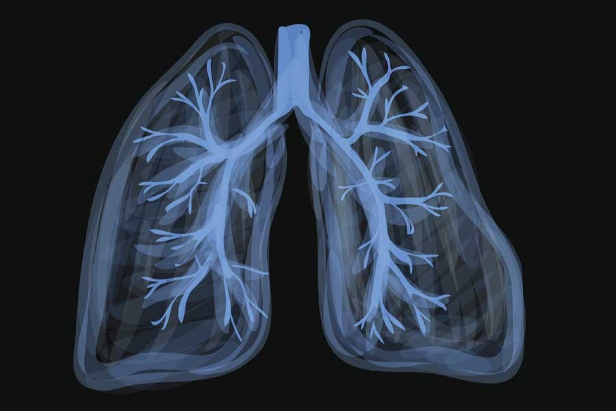 Scientists figure out how coronavirus so quickly damages lung cells