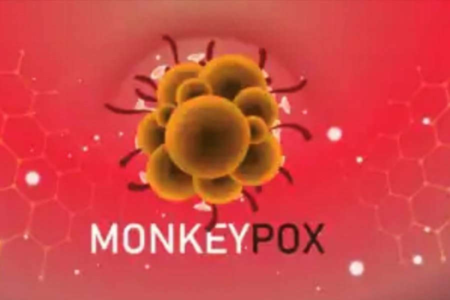 BSMMU VC urges awareness, not panic, over monkeypox 