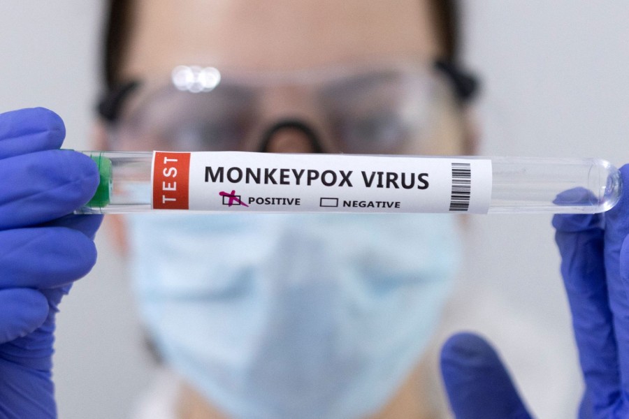 Test tubes labelled "Monkeypox virus positive" are seen in this illustration taken on May 23, 2022 — Reuters photo