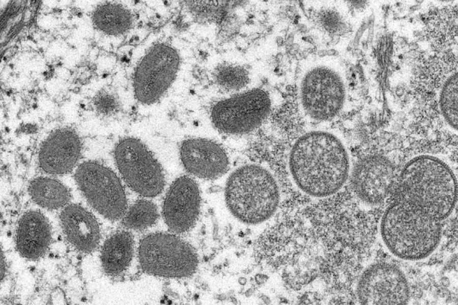 An electron microscopic (EM) image shows mature, oval-shaped monkeypox virus particles as well as crescents and spherical particles of immature virions, obtained from a clinical human skin sample associated with the 2003 prairie dog outbreak in this undated image obtained by Reuters on May 18, 2022. Cynthia S. Goldsmith, Russell Regnery/CDC/Handout via REUTERS